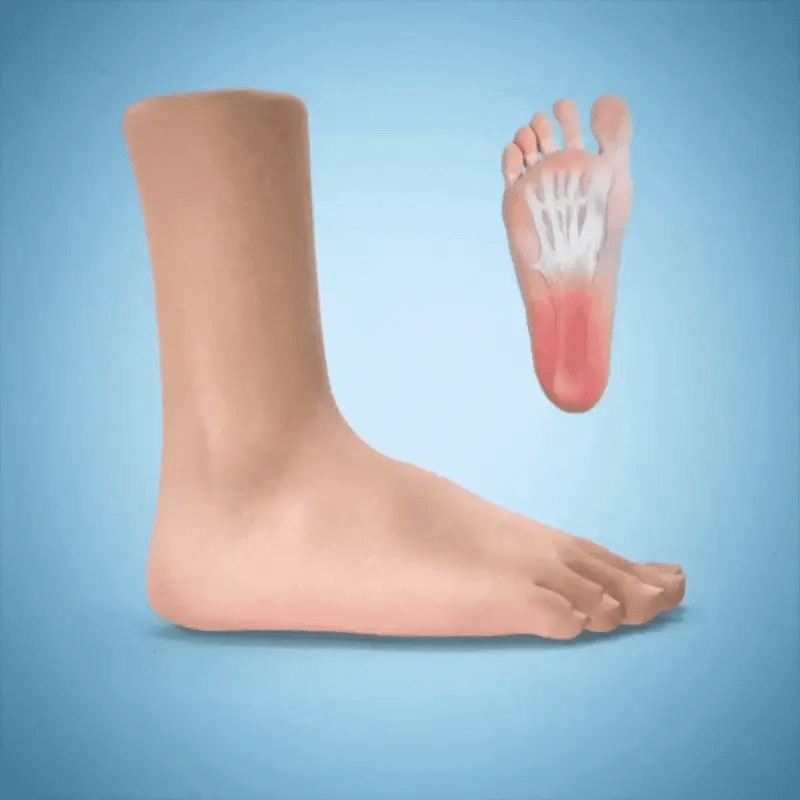 CloudStep™- Turnos de 10 Horas Sin Dolor de Pies